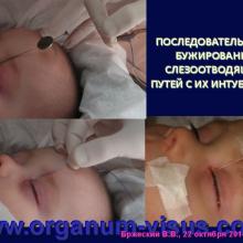 Бржеский В.В. Синдром «красного глаза»: возможности диагностики и лечения. Доклад на интернет-сессии: Инфекция в глазу! Internet-session: Ophthalmology for Therapists! (г. Москва, Россия, 22 октября 2014г.) Совместный проект портала Орган зрения organum-visus.com и Всероссийской образовательной программы для врачей "Интернет Сессия". При поддержке компании Dr.Reddy's