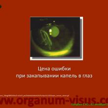 Голубев С.Ю. Офтальмология для терапевтов (Sergey Y. Golubev, Ophthalmology for therapists). Доклад на интернет-сессии: Инфекция в глазу! Internet-session: Ophthalmology for Therapists! (г. Москва, Россия, 22 октября 2014г.) Совместный проект портала Орган зрения organum-visus.com и Всероссийской образовательной программы для врачей "Интернет Сессия". При поддержке компании Dr.Reddy's