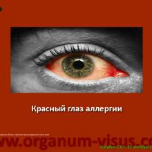 Голубев С.Ю. Офтальмология для терапевтов (Sergey Y. Golubev, Ophthalmology for therapists). Доклад на интернет-сессии: Инфекция в глазу! Internet-session: Ophthalmology for Therapists! (г. Москва, Россия, 22 октября 2014г.) Совместный проект портала Орган зрения organum-visus.com и Всероссийской образовательной программы для врачей "Интернет Сессия". При поддержке компании Dr.Reddy's