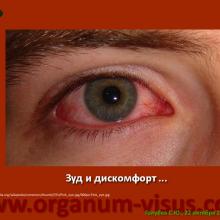 Голубев С.Ю. Офтальмология для терапевтов (Sergey Y. Golubev, Ophthalmology for therapists). Доклад на интернет-сессии: Инфекция в глазу! Internet-session: Ophthalmology for Therapists! (г. Москва, Россия, 22 октября 2014г.) Совместный проект портала Орган зрения organum-visus.com и Всероссийской образовательной программы для врачей "Интернет Сессия". При поддержке компании Dr.Reddy's