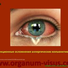 Голубев С.Ю. Офтальмология для терапевтов (Sergey Y. Golubev, Ophthalmology for therapists). Доклад на интернет-сессии: Инфекция в глазу! Internet-session: Ophthalmology for Therapists! (г. Москва, Россия, 22 октября 2014г.) Совместный проект портала Орган зрения organum-visus.com и Всероссийской образовательной программы для врачей "Интернет Сессия". При поддержке компании Dr.Reddy's