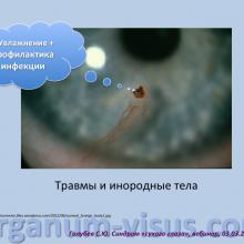 Голубев Сергей Юрьевич (г. Москва, Россия) доклад на вебинаре 03 марта 2016г. в рамках совместного образовательного проекта портала Орган зрения www.organum-visus.com и компании URSAPHARM.  Webinar treatment of dry eye. Часть 2.