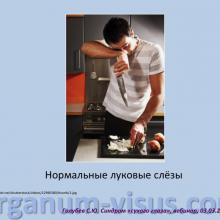 Голубев Сергей Юрьевич (г. Москва, Россия) доклад на вебинаре 03 марта 2016г. в рамках совместного образовательного проекта портала Орган зрения www.organum-visus.com и компании URSAPHARM.  Webinar treatment of dry eye. Часть 3.