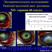 Кваша О.И. NO-терапия в офтальмотравматологии. Экспериментально-клиническое исследование. Гундорова Р.А., Чеснокова Н.Б., Кваша О.И., Шехтер А.Б., Пекшев А.В., Давыдова Н.Г., Безнос О.В., Столярова Е.П., Горбачева О.В., Косакян С.М., Сиала С. (МНИИ глазных болезней им. Гельмгольца (директор - д.м.н., профессор В.В.Нероев) Отдел травм органа зрения, реконструктивной хирургии и глазного протезирования (руководитель – д.м.н., профессор Р.А.Гундорова)), Kvasha O.I. NO-therapy in ophthalmology.