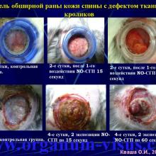Кваша О.И. NO-терапия в офтальмотравматологии. Экспериментально-клиническое исследование. Гундорова Р.А., Чеснокова Н.Б., Кваша О.И., Шехтер А.Б., Пекшев А.В., Давыдова Н.Г., Безнос О.В., Столярова Е.П., Горбачева О.В., Косакян С.М., Сиала С. (МНИИ глазных болезней им. Гельмгольца (директор - д.м.н., профессор В.В.Нероев) Отдел травм органа зрения, реконструктивной хирургии и глазного протезирования (руководитель – д.м.н., профессор Р.А.Гундорова)), Kvasha O.I. NO-therapy in ophthalmology.