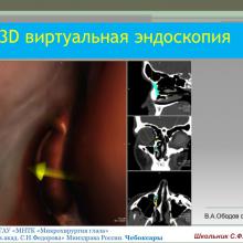 Школьник С.Ф. Новое в дакриологии. Уральская панорма-2015. Информационный партнер портал Орган зрения www.organum-visus.com