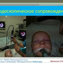 Школьник С.Ф. Новое в дакриологии. Уральская панорма-2015. Информационный партнер портал Орган зрения www.organum-visus.com